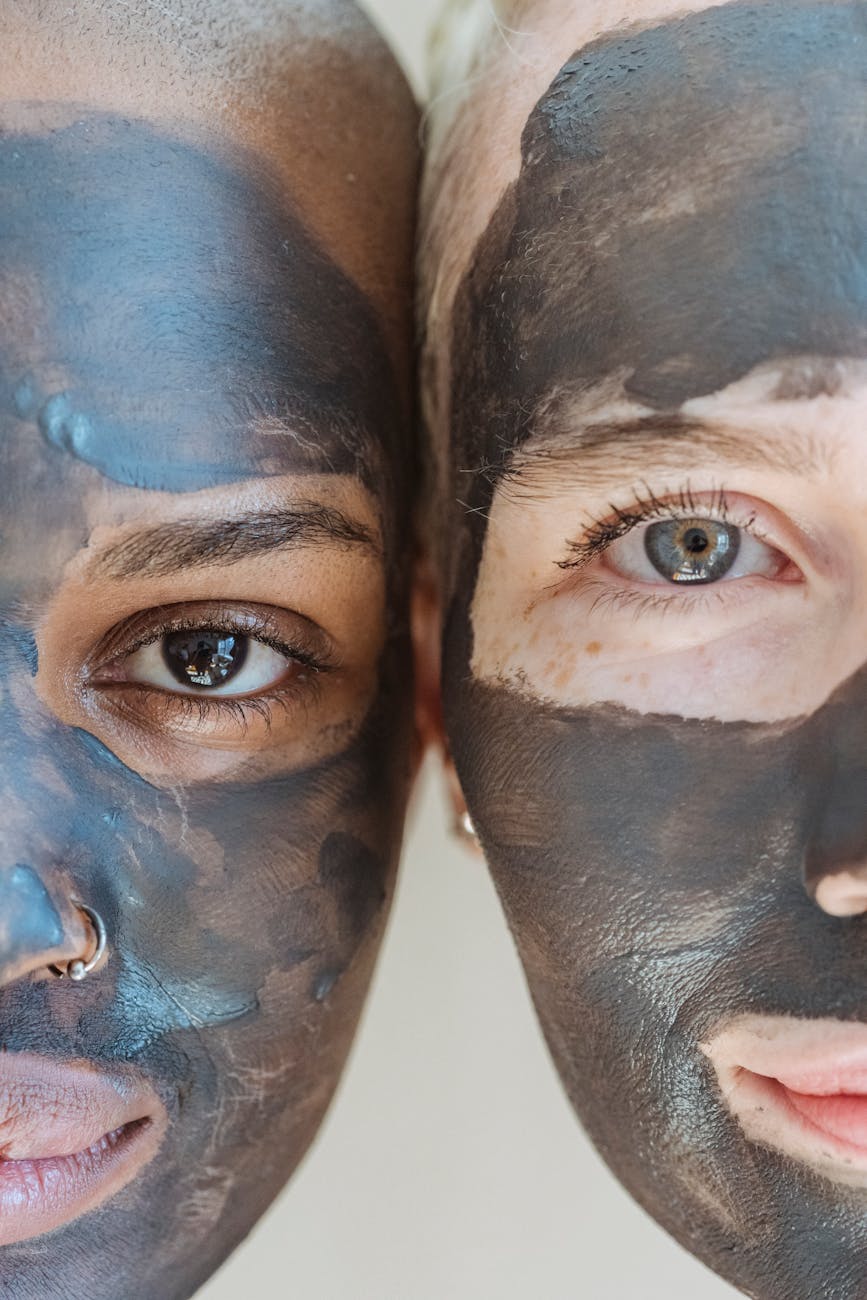 Carbon peel treatment at True Bliss Medical
