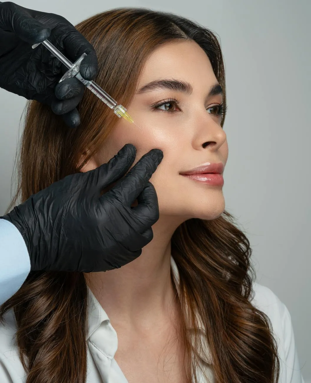 Cheek Filler for Midface Volume and Lift