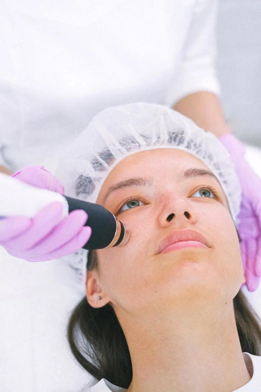 Chemical Peel for Hyperpigmentation and Melasma
