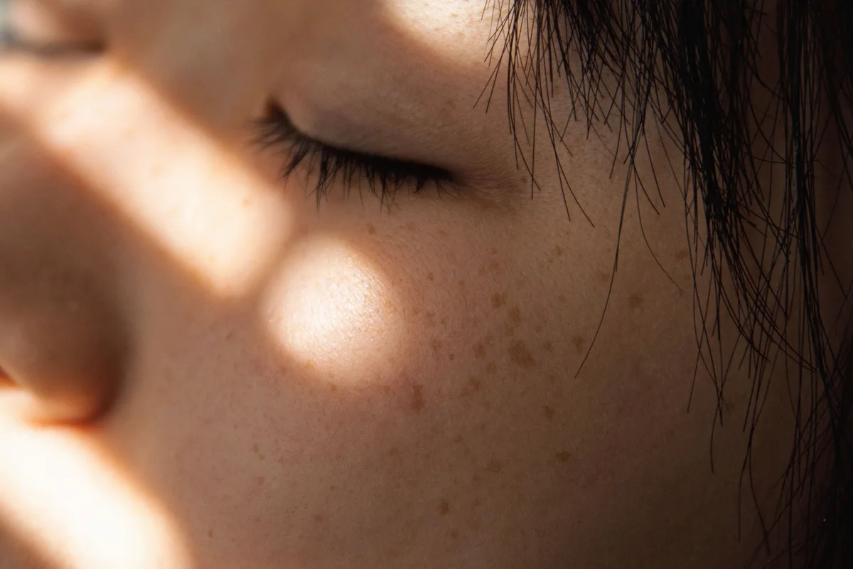 CoolPeel for Sun Damage