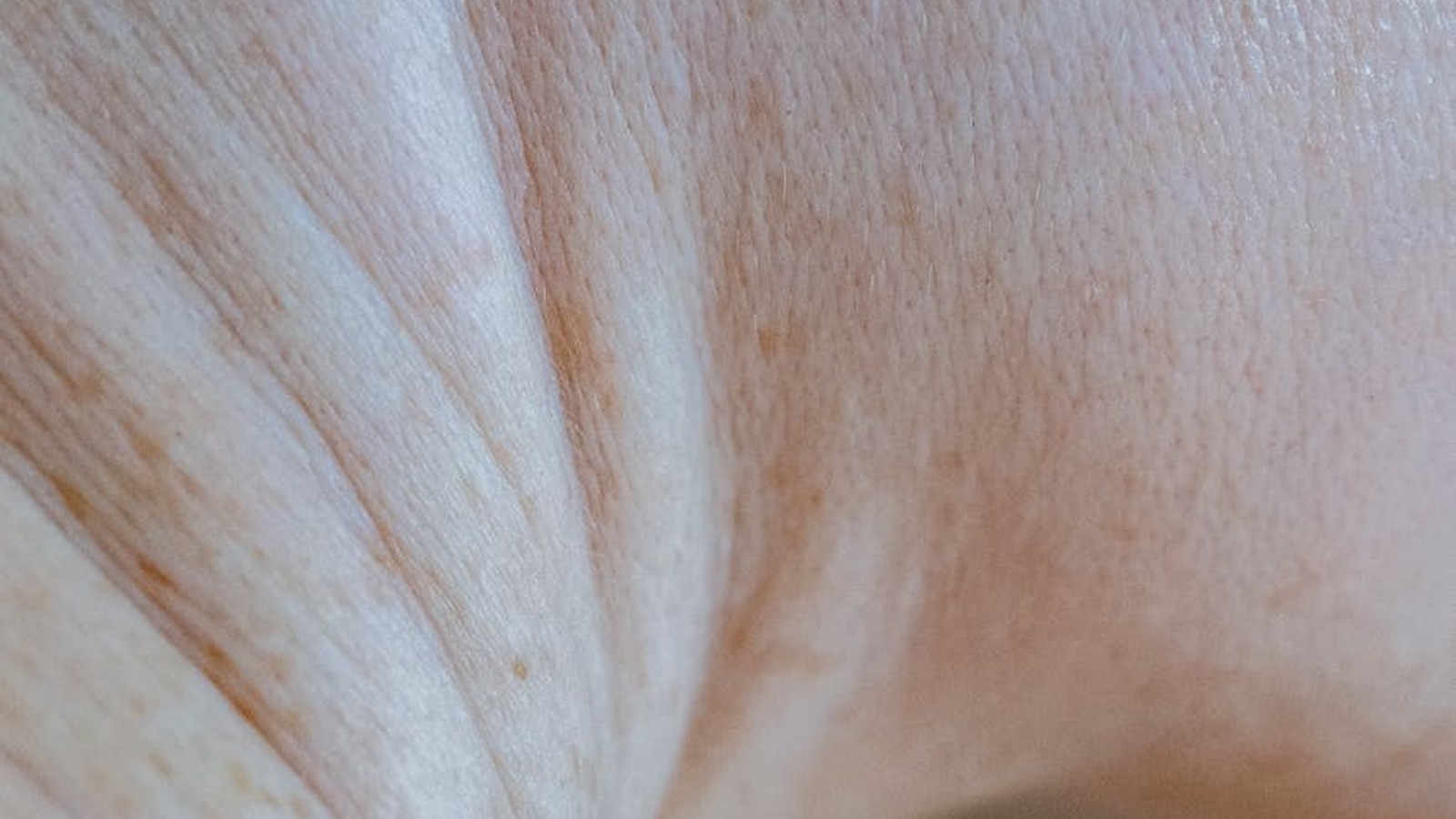 Endolaser vs Morpheus8 vs Ultherapy