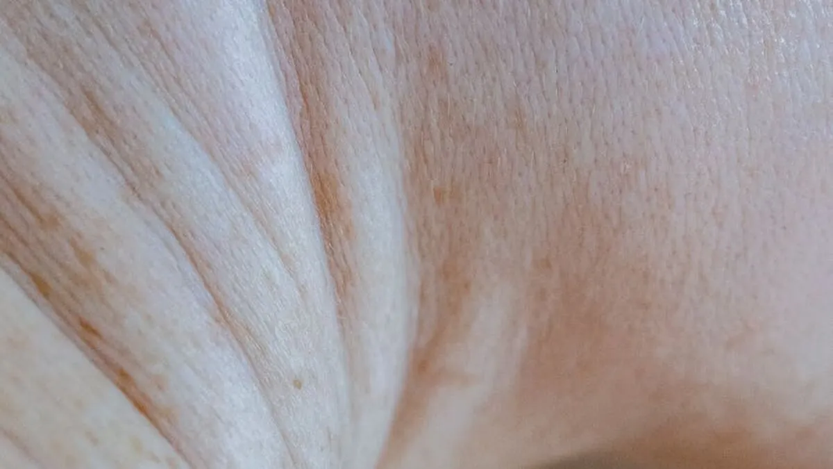 Endolaser vs Morpheus8 vs Ultherapy