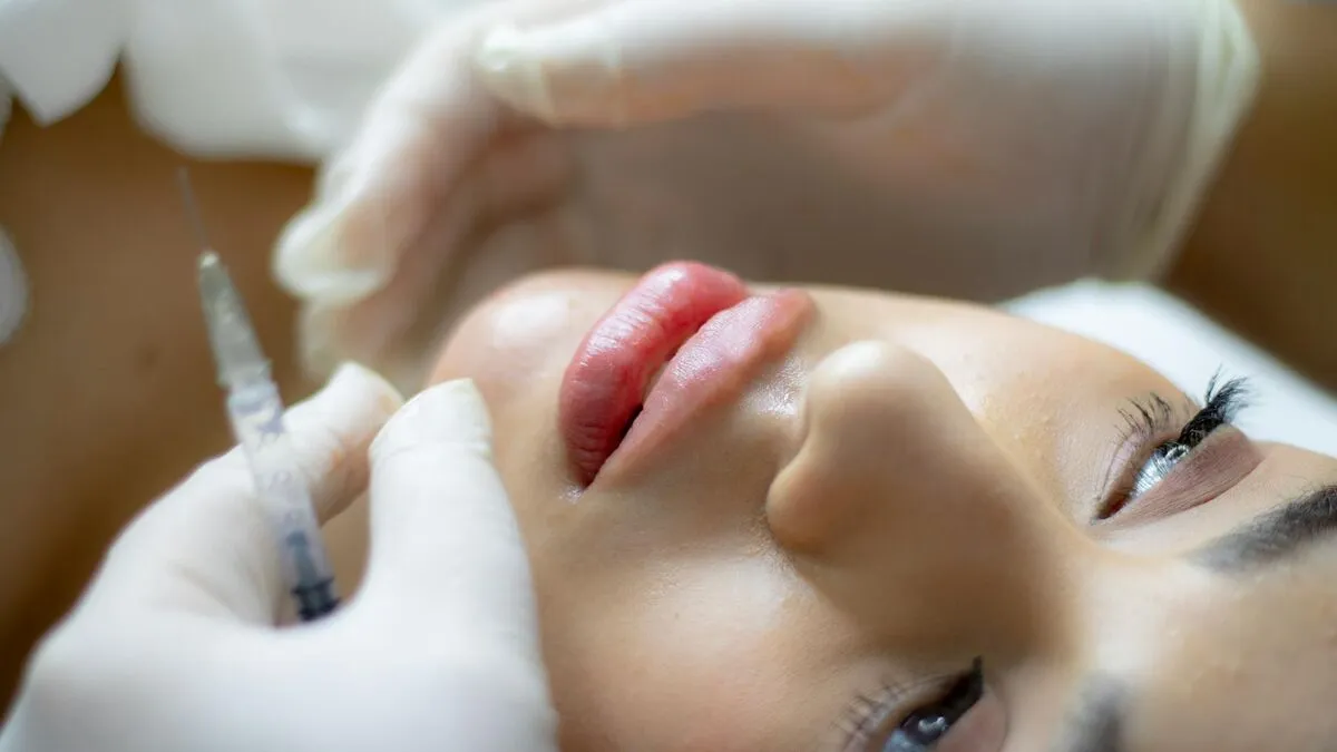 Lip Fillers for Natural Results Explained