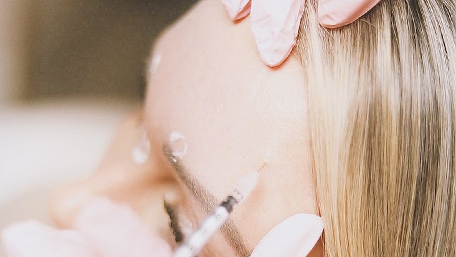 Preventative Botox: When Should You Start?