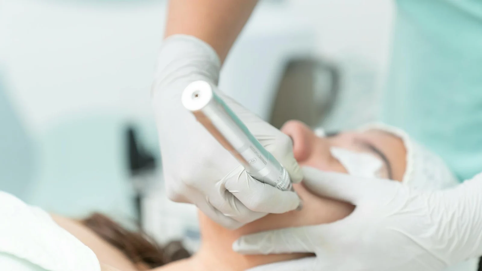 What Is PRP Microneedling?