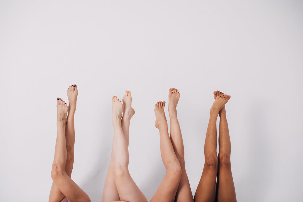 Radiesse for cellulite treatment at True Bliss Medical