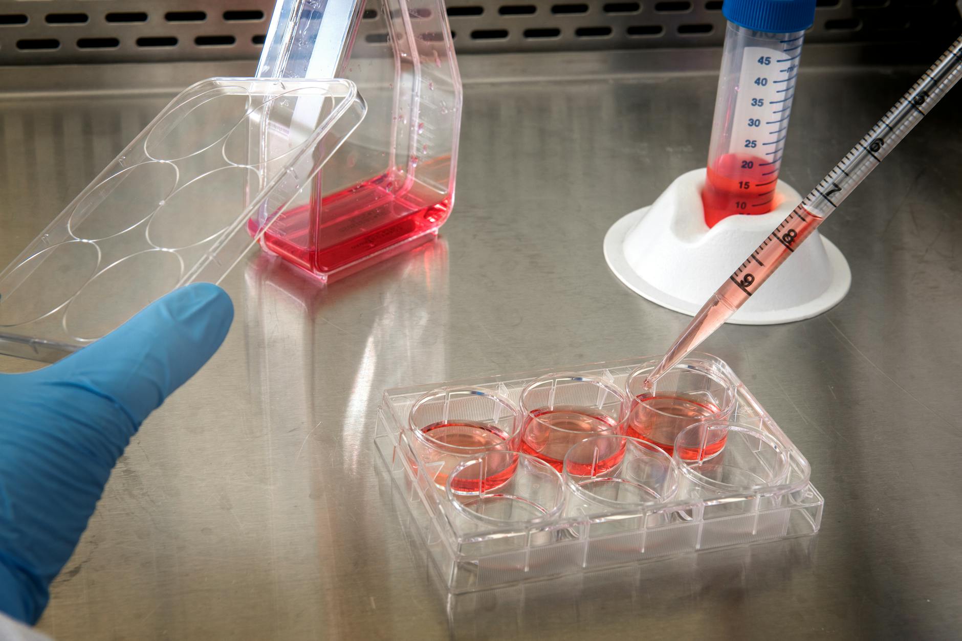 What Is Stem Cell Banking and Why Consider It?