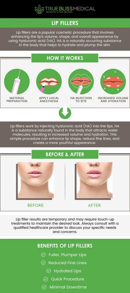 Med Spa Near Wayne, NJ — Lip Filler