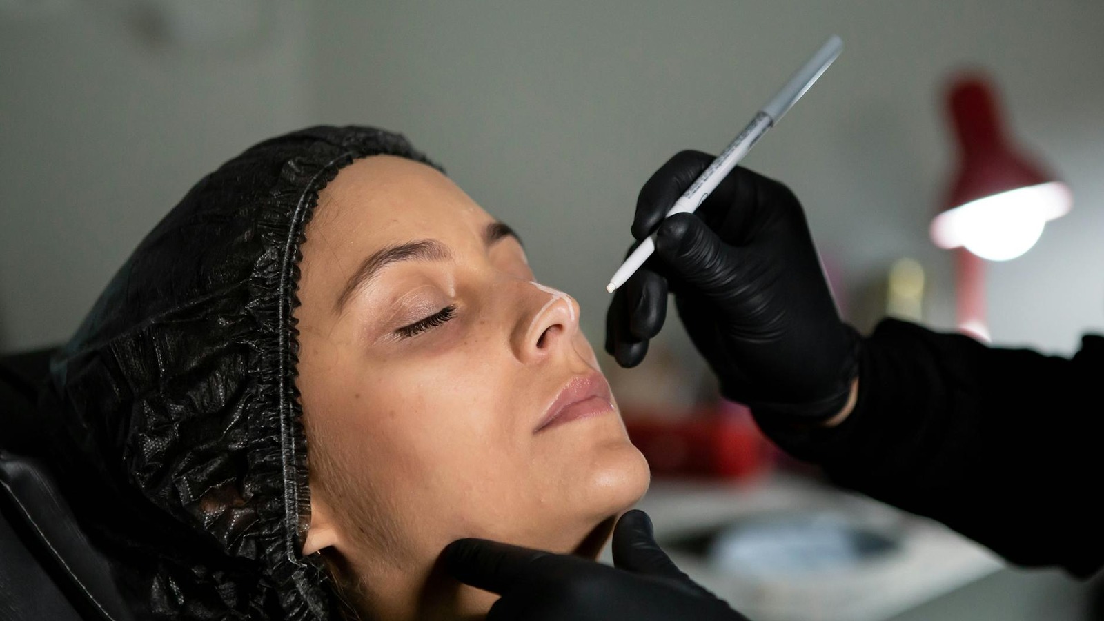 Under-Eye Hollows & Dark Circles: Treatment Options