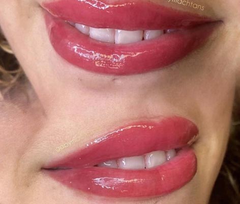 Lip Blushing Specialist Near Me in Verona NJ Lip Blushing Specialist Near Me in Verona NJ