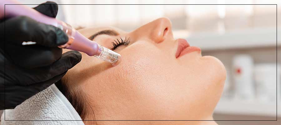 Benefits of Microneedling Treatment Near Me in Verona NJ