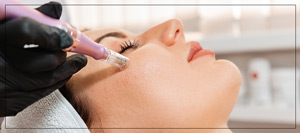 Benefits of Microneedling Treatment Near Me in Verona NJ