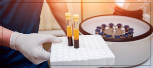 Platelet Rich Platelets (PRP) Therapy Specialist Near Me in Verona, NJ Platelet Rich Platelets (PRP) Therapy Specialist Near Me in Verona, NJ