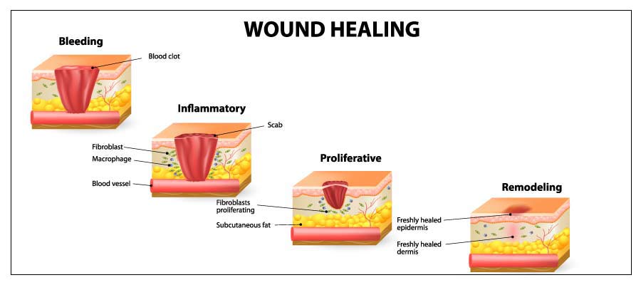 Exosome Stem Cell Therapy Near Me in Verona, NJ