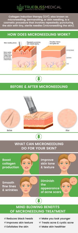 Microneedling improves the look and feel of your skin, but it can also work wonders in reducing acne scars, lines, and wrinkles. Visit True Bliss Medical to get your microneedling treatment with our experienced medical professionals. We can help you achieve your aesthetic goals. Contact us today or schedule an appointment online! We are conveniently located at 96 Pompton Ave Suite 102, Verona, NJ 07044. 