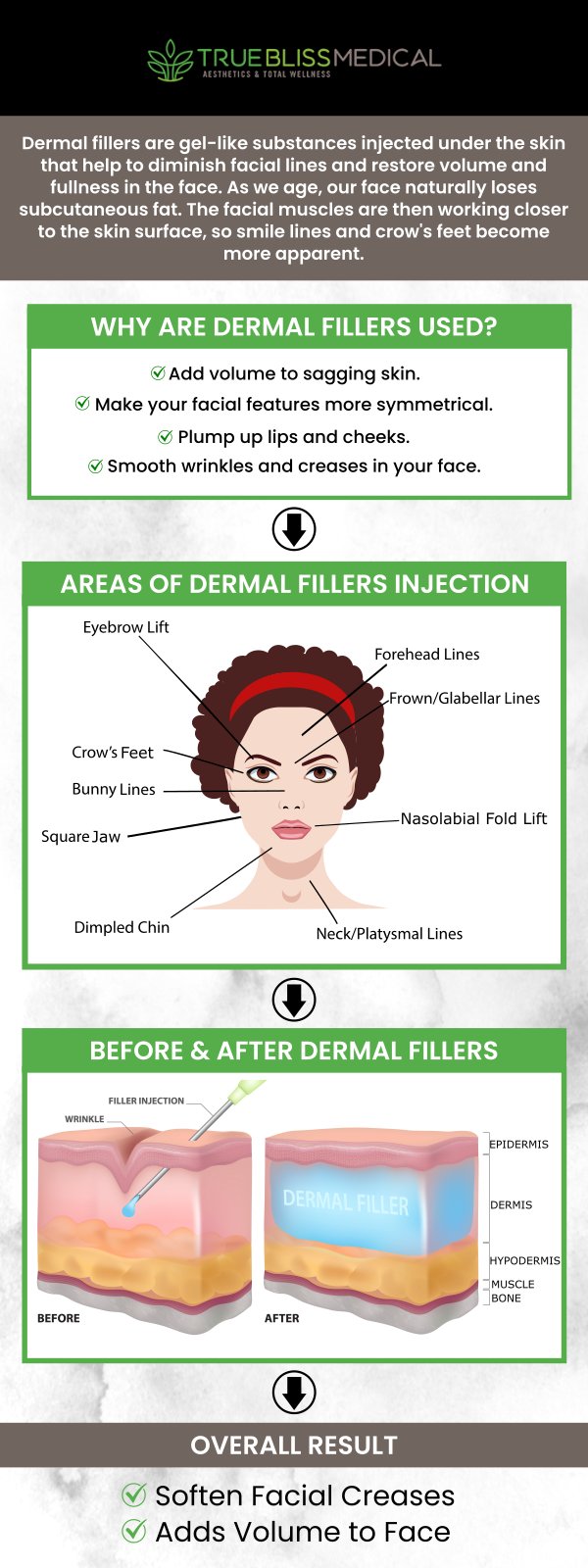 Our highly qualified team of aesthetic and medical experts at True Bliss Medical offers dermal fillers. Contact us today for more information or schedule an appointment online to learn the benefits of dermal filler. Our medical spa is conveniently located at 96 Pompton Ave Suite 102, Verona, NJ 07044.