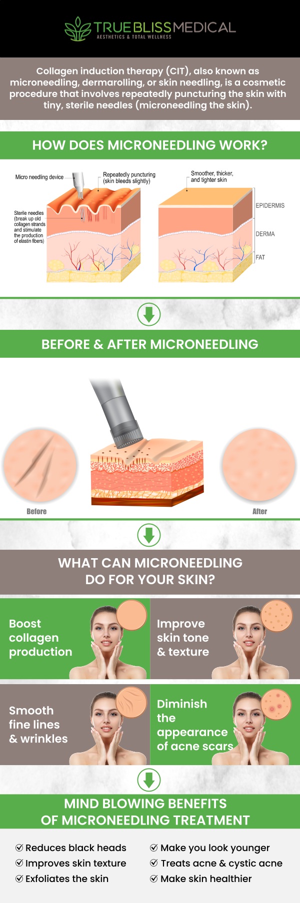 RF microneedling is an advanced skin treatment that combines microneedling with radiofrequency energy to stimulate collagen production and improve skin texture. At True Bliss Medical, Dr. Alexander Rios, MD, offers this procedure to address concerns like fine lines, acne scars, and skin laxity, helping to restore smoother, firmer skin for a more youthful appearance. This non-invasive treatment also promotes overall skin rejuvenation and can be customized to meet individual skin needs for optimal results. For more information, contact us or book an appointment online. We are conveniently located at 96 Pompton Ave Suite 102, Verona, NJ 07044. RF microneedling is an advanced skin treatment that combines microneedling with radiofrequency energy to stimulate collagen production and improve skin texture. At True Bliss Medical, Dr. Alexander Rios, MD, offers this procedure to address concerns like fine lines, acne scars, and skin laxity, helping to restore smoother, firmer skin for a more youthful appearance. This non-invasive treatment also promotes overall skin rejuvenation and can be customized to meet individual skin needs for optimal results. For more information, contact us or book an appointment online. We are conveniently located at 96 Pompton Ave Suite 102, Verona, NJ 07044.