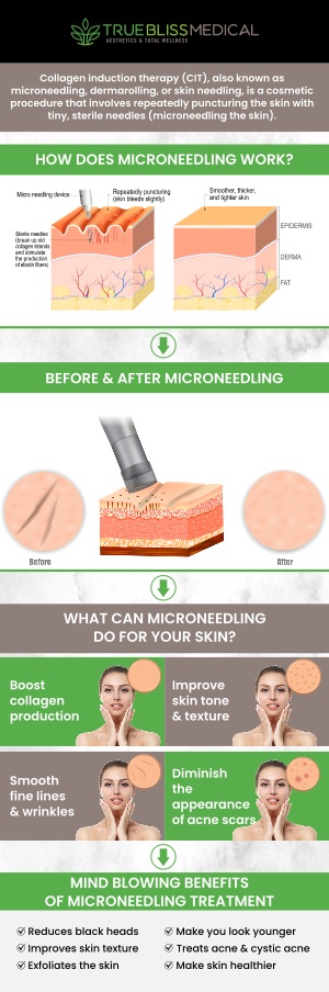 RF microneedling is an advanced skin treatment that combines microneedling with radiofrequency energy to stimulate collagen production and improve skin texture. At True Bliss Medical, Dr. Alexander Rios, MD, offers this procedure to address concerns like fine lines, acne scars, and skin laxity, helping to restore smoother, firmer skin for a more youthful appearance. This non-invasive treatment also promotes overall skin rejuvenation and can be customized to meet individual skin needs for optimal results. For more information, contact us or book an appointment online. We are conveniently located at 96 Pompton Ave Suite 102, Verona, NJ 07044. RF microneedling is an advanced skin treatment that combines microneedling with radiofrequency energy to stimulate collagen production and improve skin texture. At True Bliss Medical, Dr. Alexander Rios, MD, offers this procedure to address concerns like fine lines, acne scars, and skin laxity, helping to restore smoother, firmer skin for a more youthful appearance. This non-invasive treatment also promotes overall skin rejuvenation and can be customized to meet individual skin needs for optimal results. For more information, contact us or book an appointment online. We are conveniently located at 96 Pompton Ave Suite 102, Verona, NJ 07044.